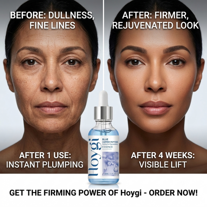 Hoygi Blue Copper Peptide Firming Moisturizing